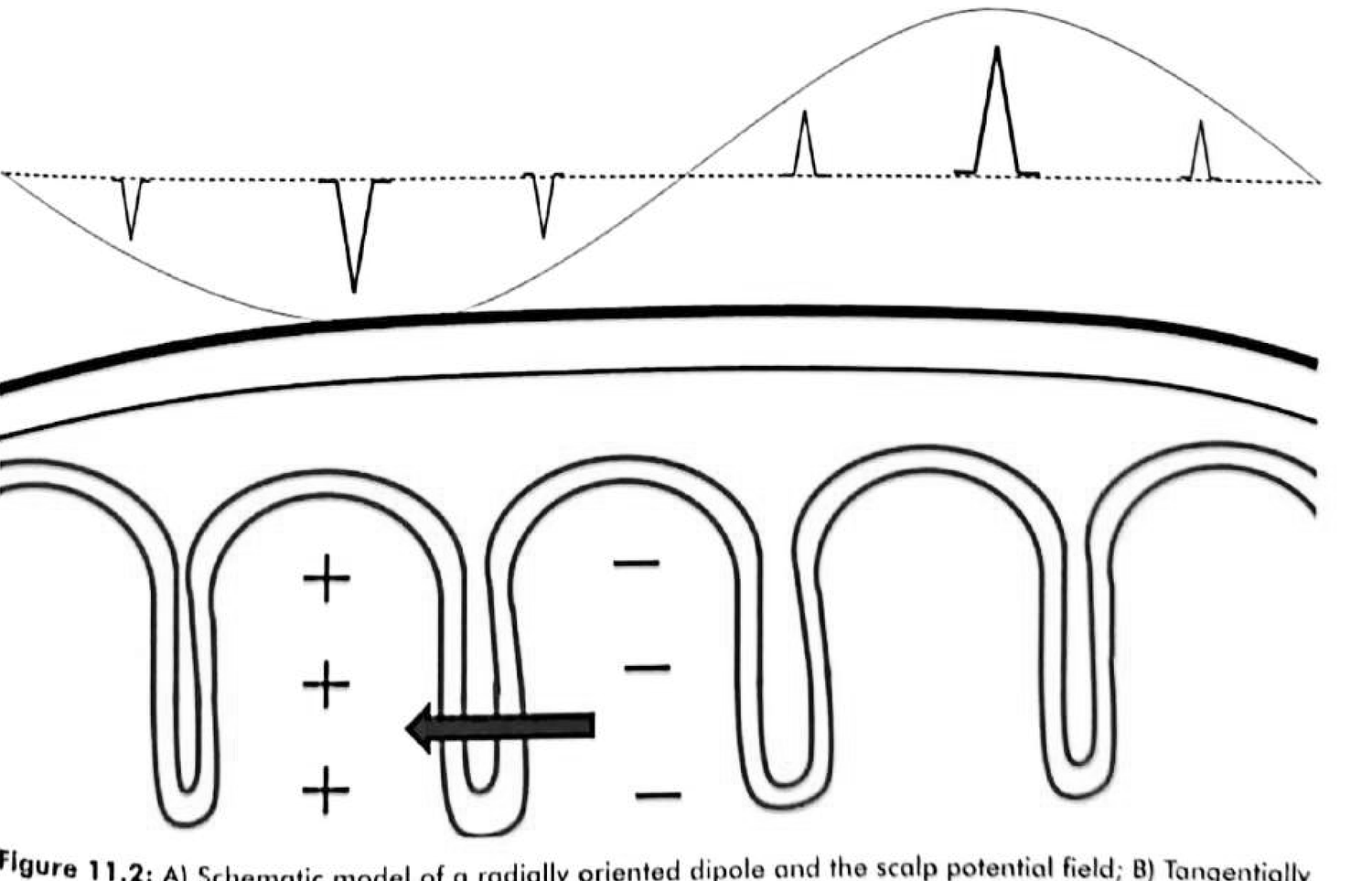 Figure 11.2 B · Tangentially oriented dipole arising from the sulcus, creating a surface-positive field posterior and a surface-negative field anterior to the source.